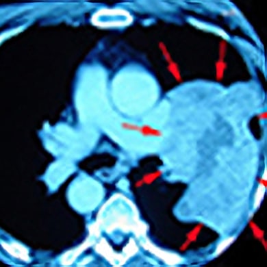 Computed Tomography Protocols