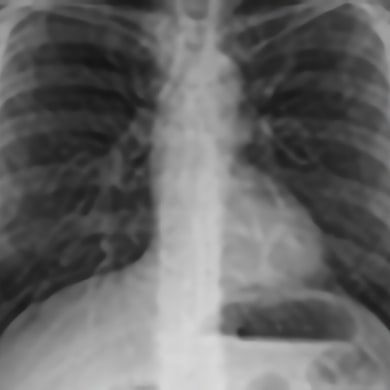 Diagnostic Imaging/Fluoroscopy Protocols