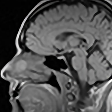 Magnetic Resonance Protocols