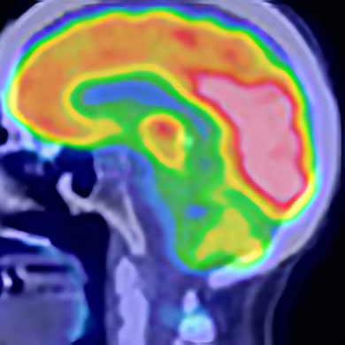 Nuclear Medicine Protocols