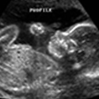 Ultrasound Protocols