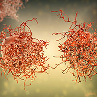 Liver Cancer