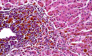 Pink and purple micrograph of liver cells and tissues