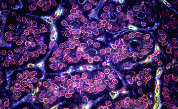 Pink, blue, and yellow cells and capillaries