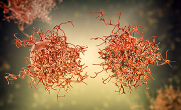 Cervical cancer cells, computer illustration