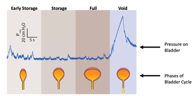 Pves over 20 cm H20 divided by 5s; Pressure on Bladder; Phases of Bladder Cycle