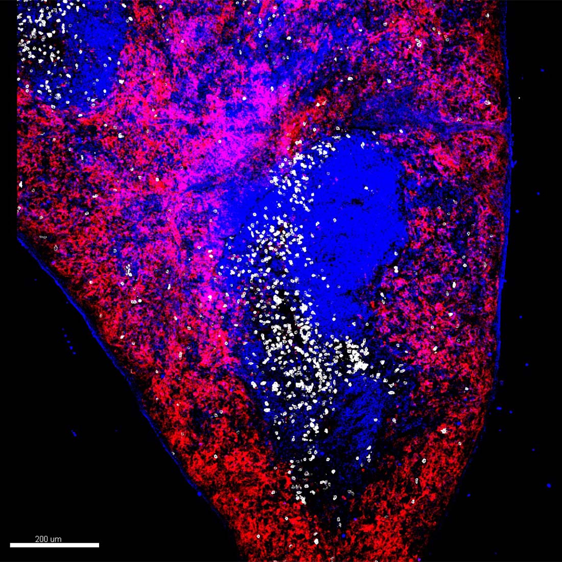Photo of CD8 T cells are a type of white blood cells that are essential for the immune system to fight infections and cancer.