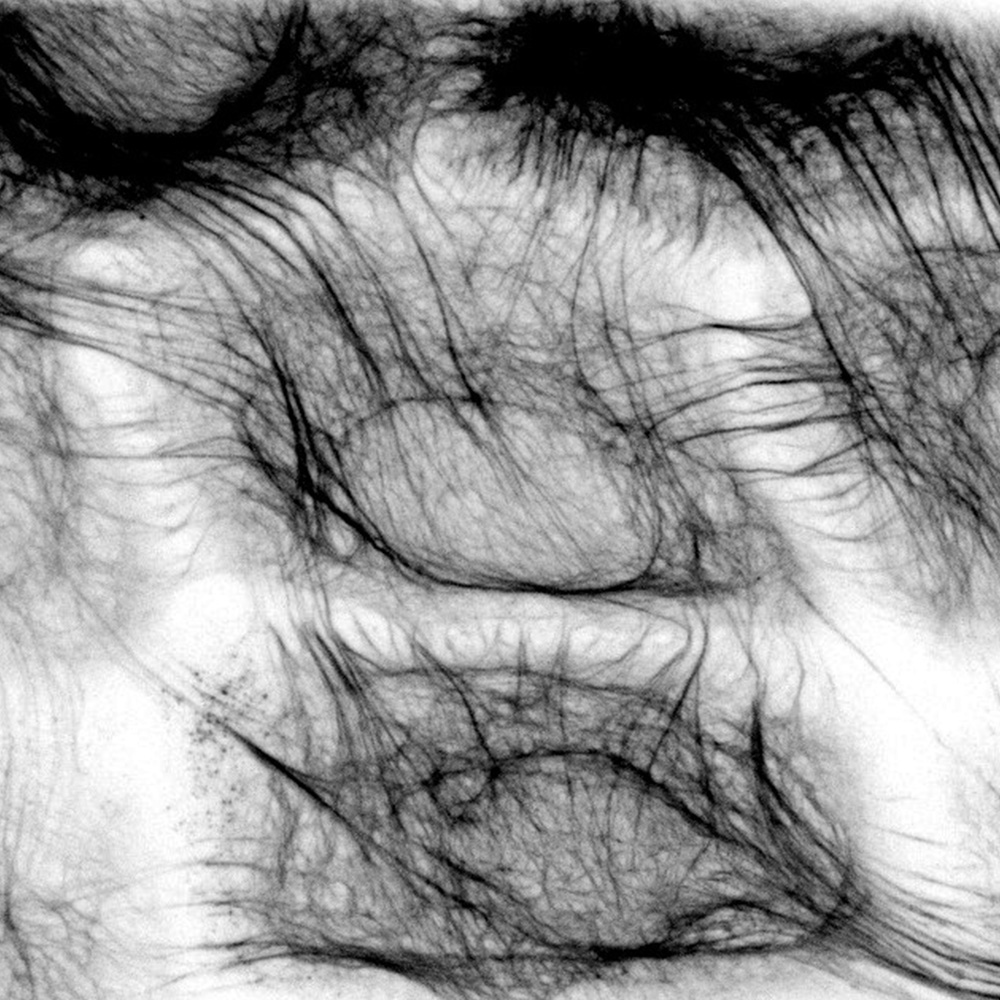 keratin filament scaffolding in skin cells