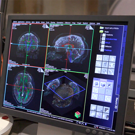 Advancing Neuromodulation Therapies