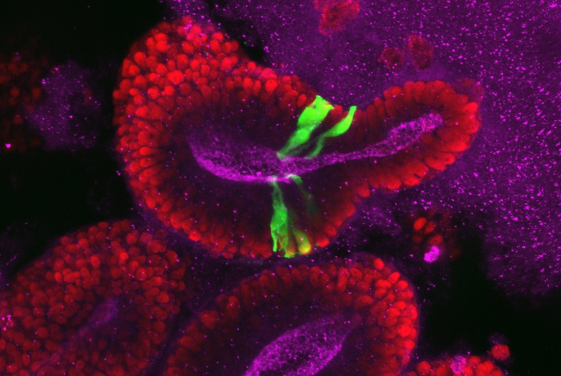 This image shows a human brain organoid