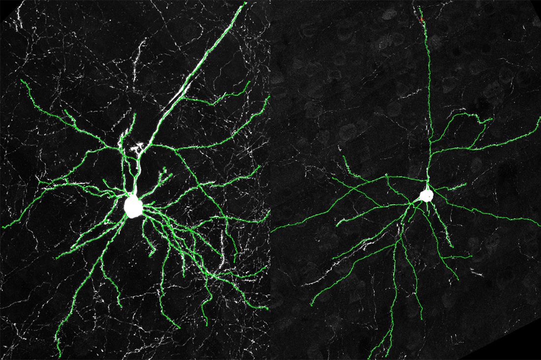 Cerebral cortexes of humanized mice (left) and wild-type mice (right)
