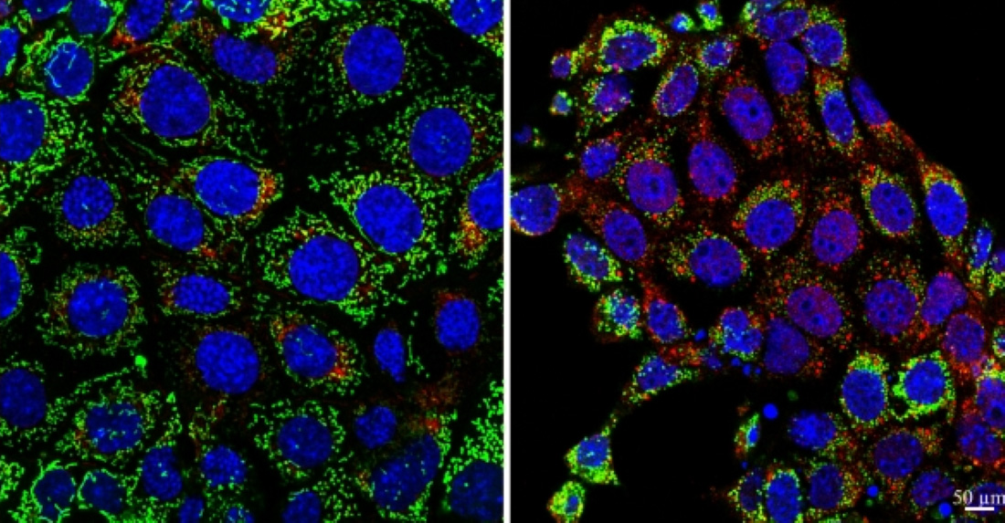 Mouse kidney cells 