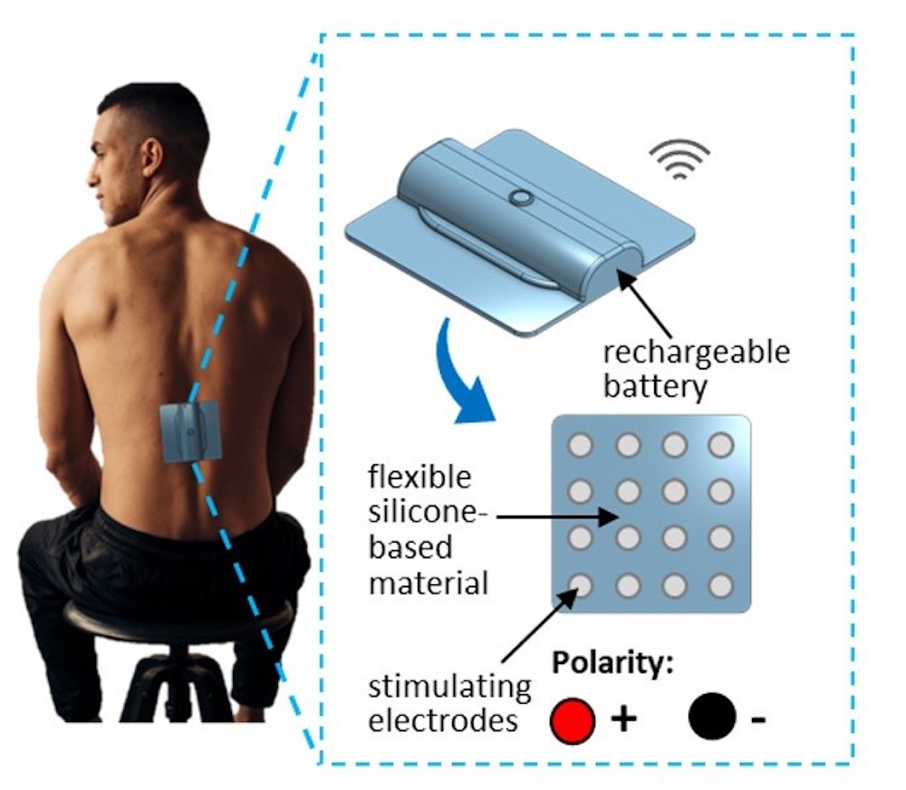 Electrode grid