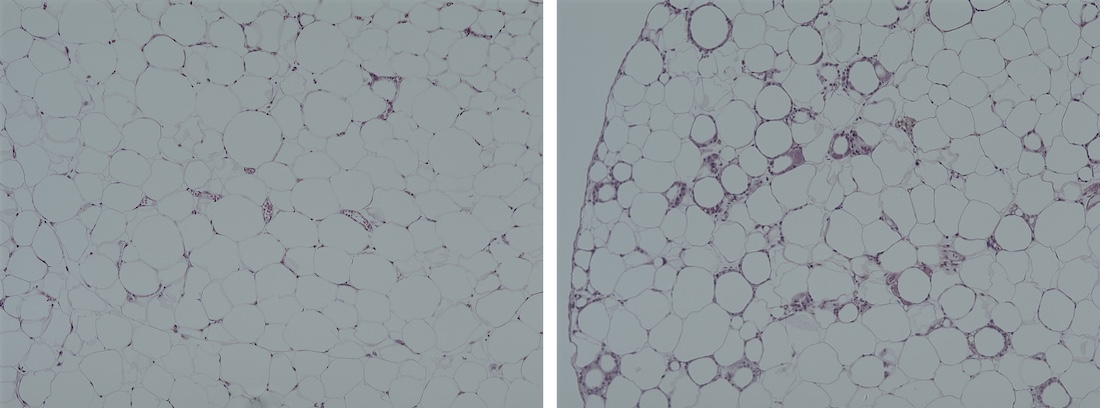 healthy and functional fat tissue exposed