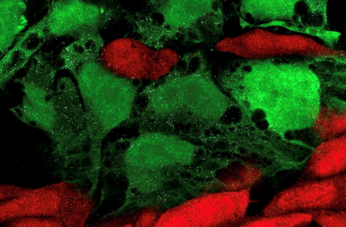 Tiny human RNA molecules (shown as white dots) move from human cells into neighboring mouse cells, activating those cells&rsquo; antiviral defense system.