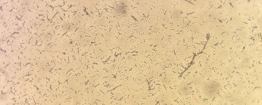 Microscopic view showing the injectable, biodegradable scaffold vaccine