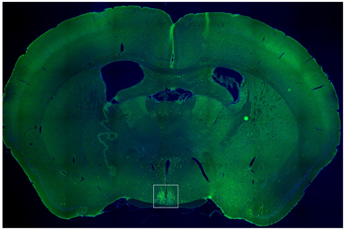 A thin slice from the middle of a mouse brain
