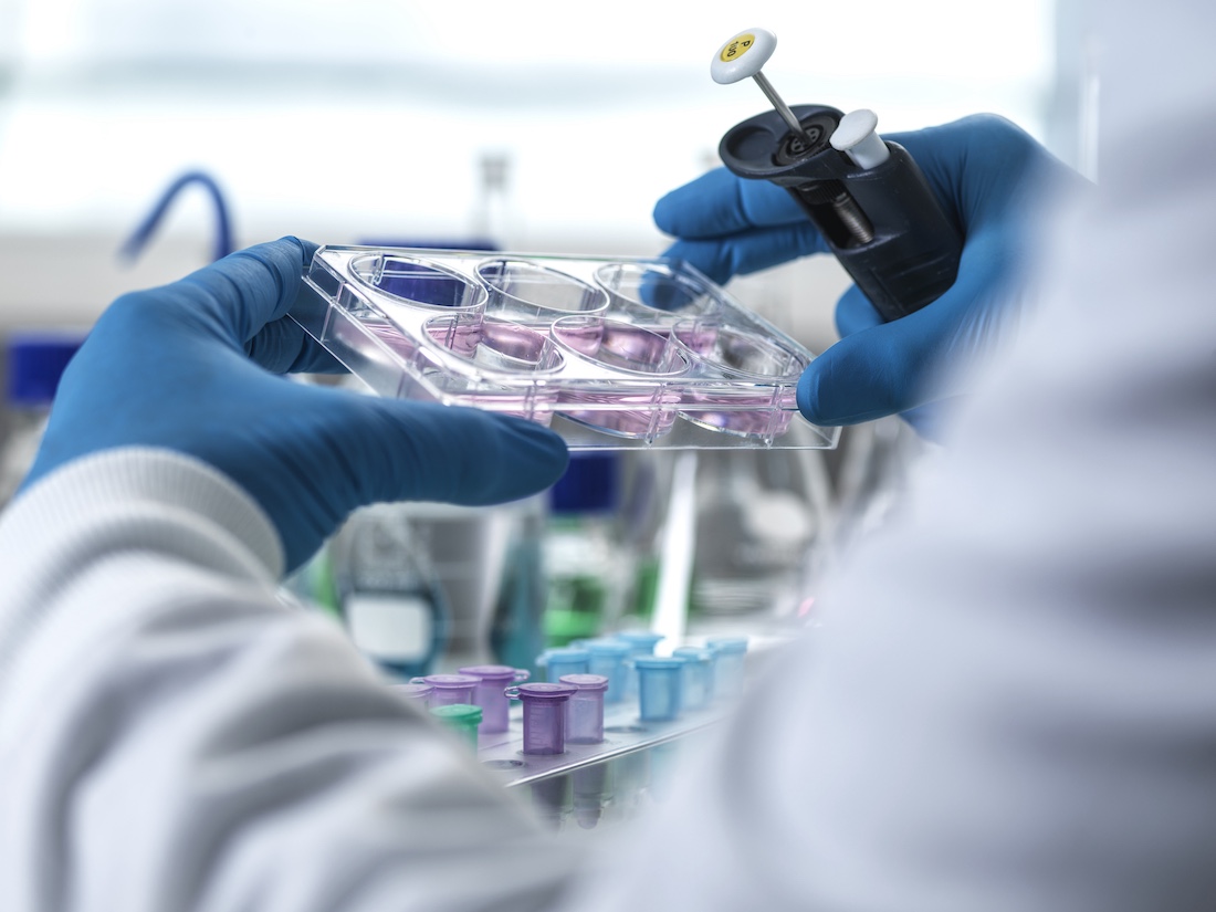 Scientist pipetting liquid into a cell culture plate