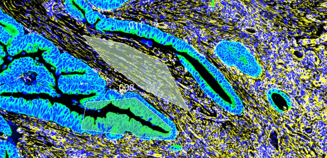 3D illustration shows tau proteins