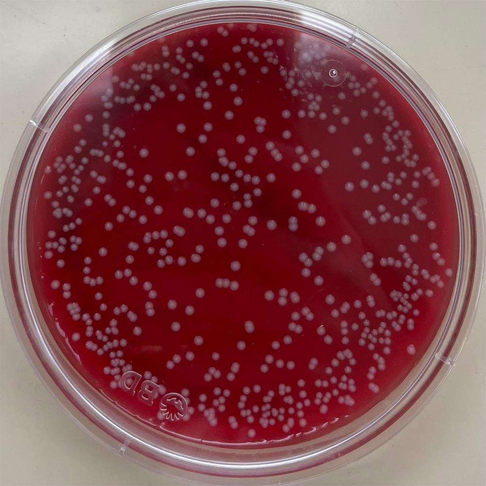 A sample of methicillin-resistant Staphylococcus aureus (MRSA) 