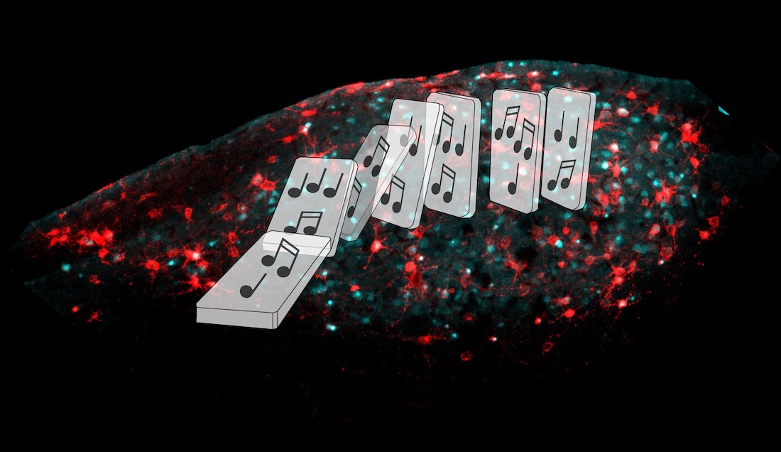 Brain dominos