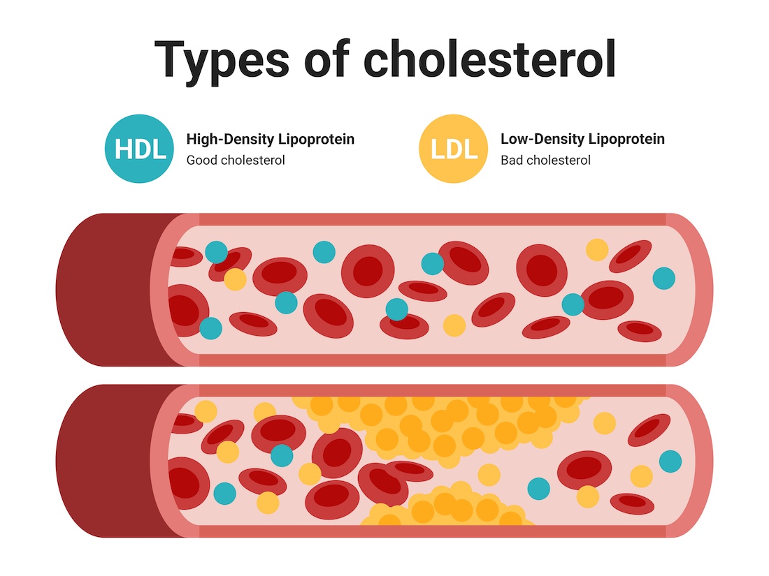 Type of cholesterol in human blood vessels.