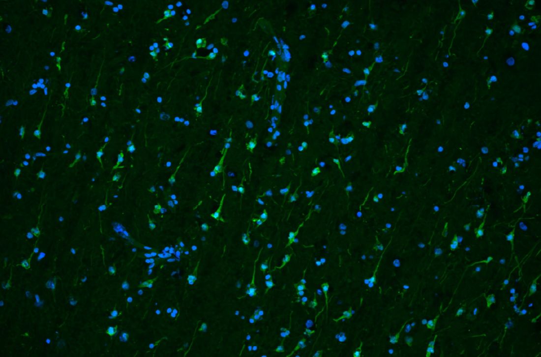 microscopic image of brain tissue