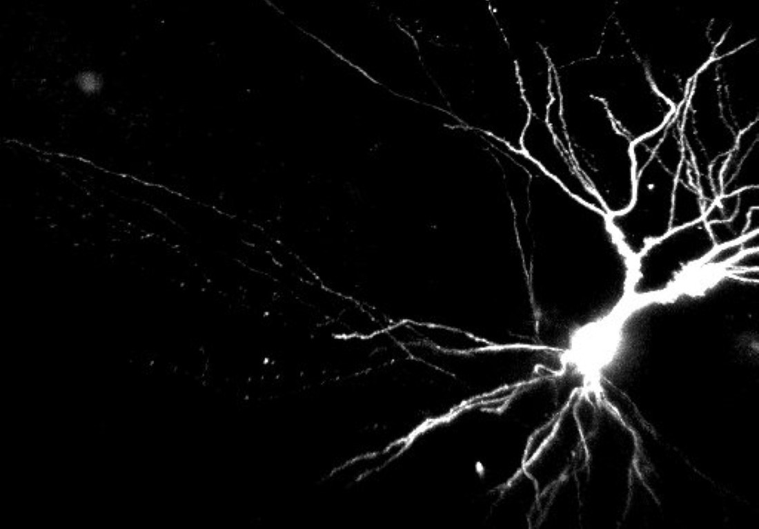 mouse neuron