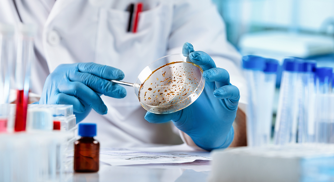 researcher working with petri dish