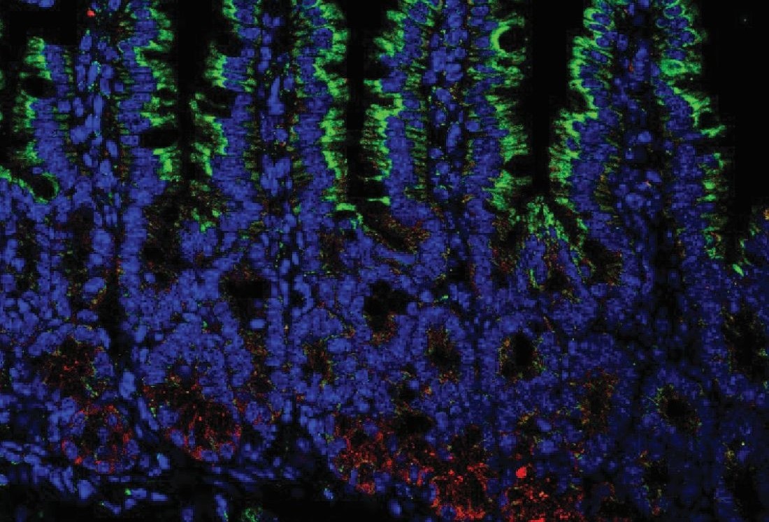 Immunofluorescence microscopy of the small intestine