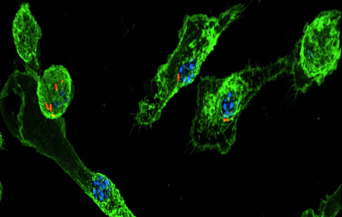 Immunofluorescence microscopy demonstrates Mycobacterium tuberculosis