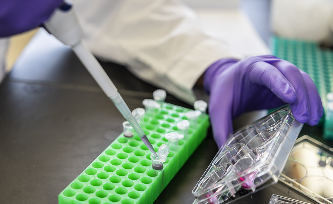 lab samples