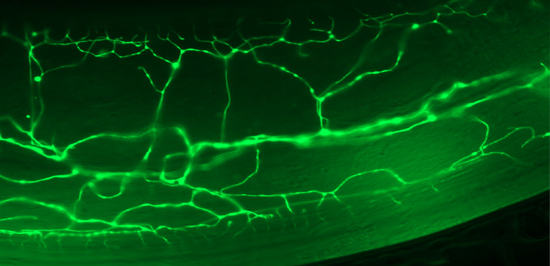 A stress‑sensing nerve cell