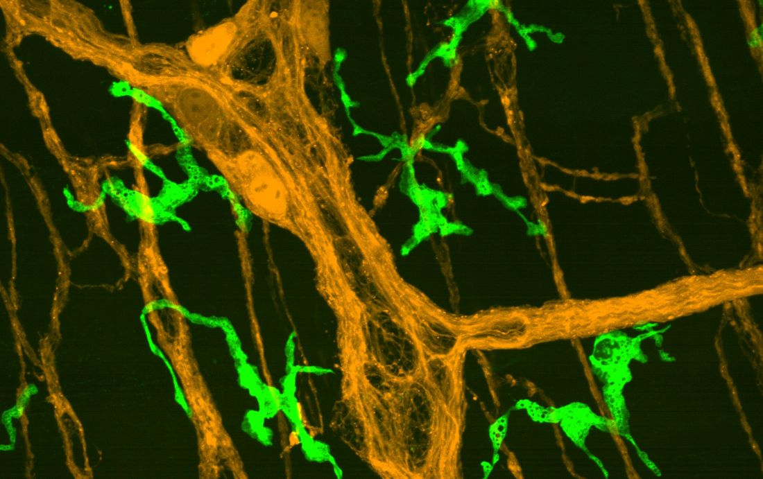 enteric neurons and macrophages