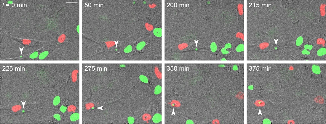 Live-cell microscopy
