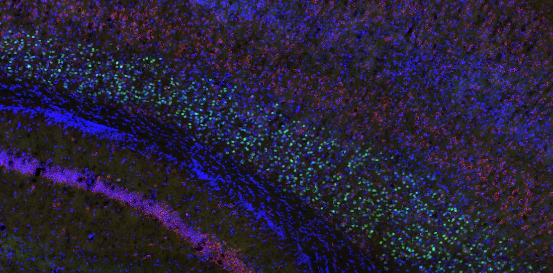 Microscopic view of a mouse&rsquo;s cerebral cortex highlights