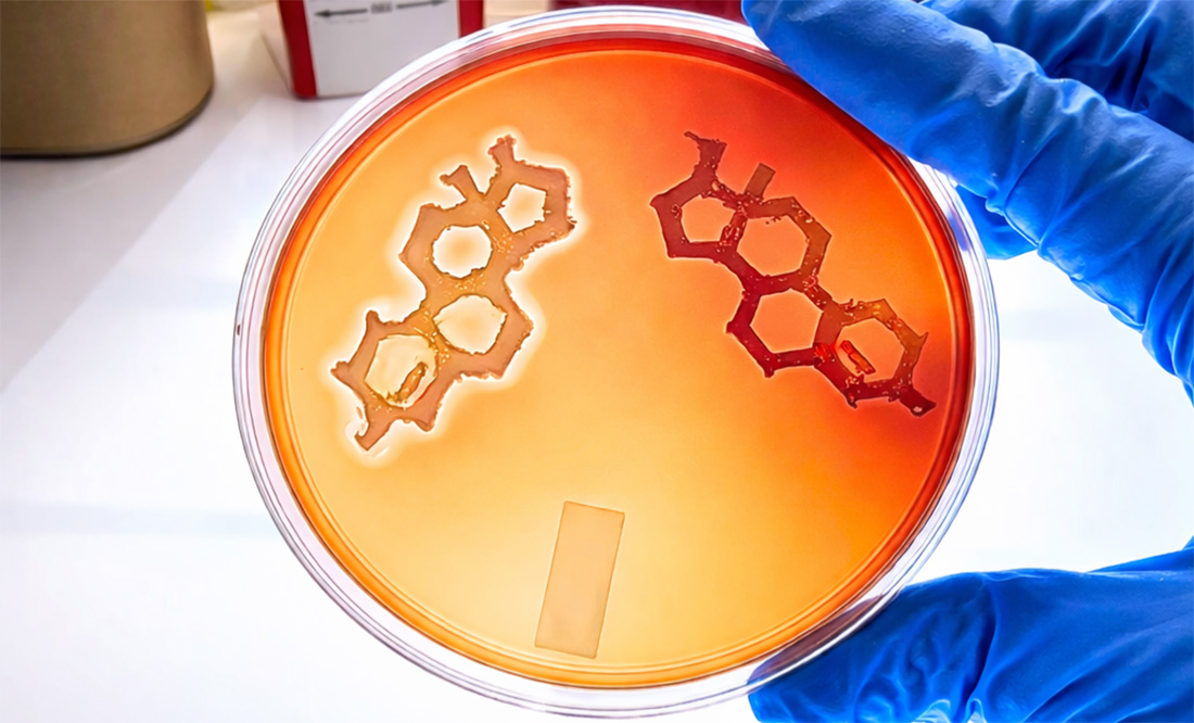 Laboratory image shows Staphylococcus aureus bacteria