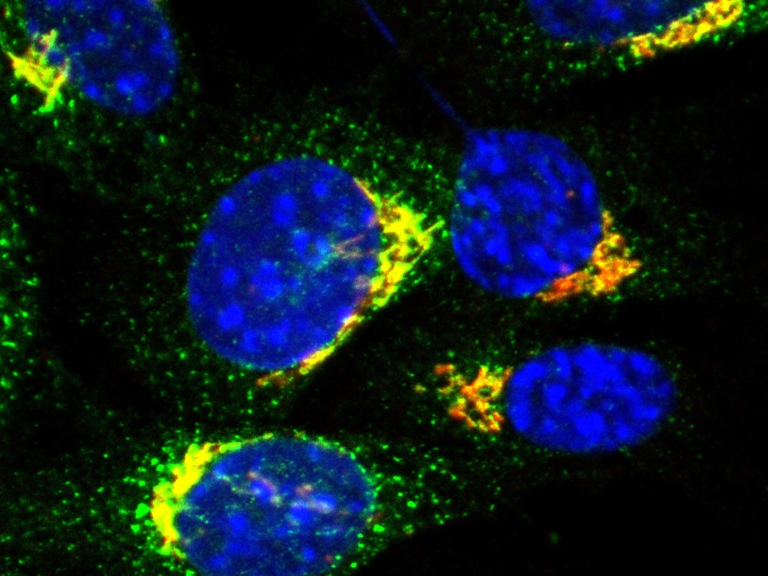 microscopic image shows mammalian cells with the Golgi apparatus