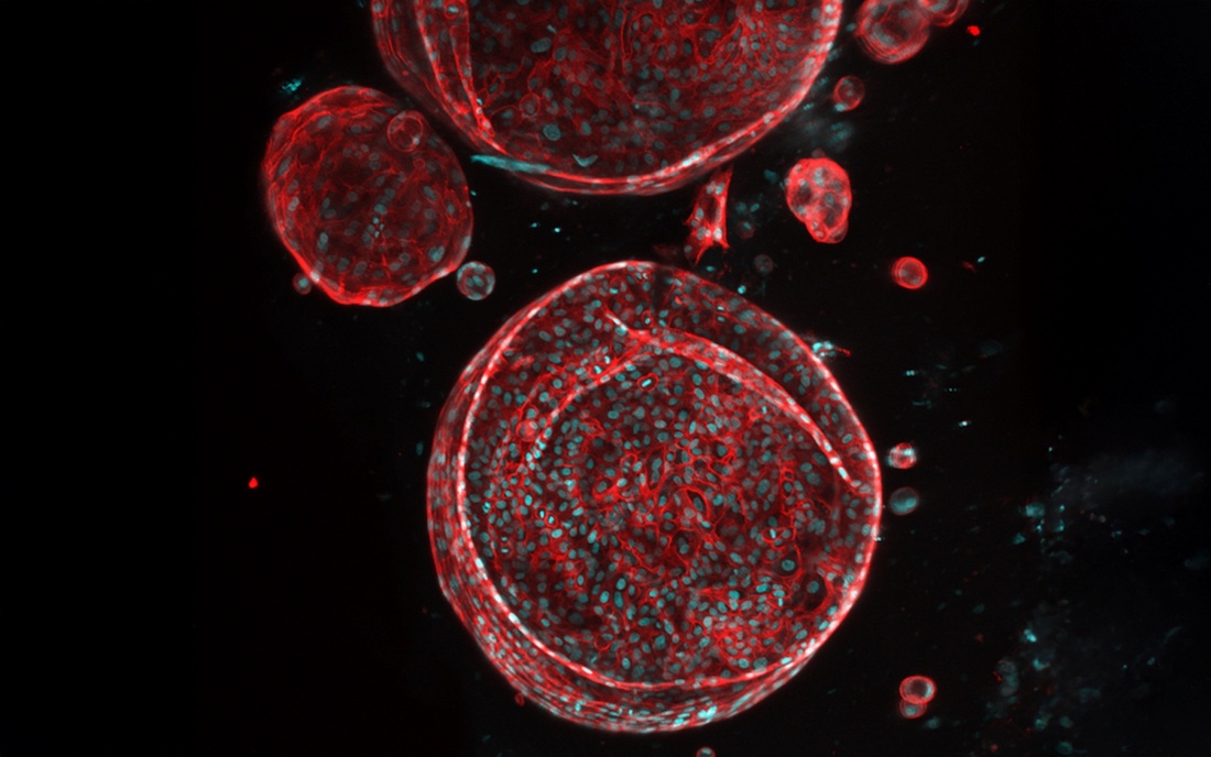 Patient biopsy-derived liver organoids