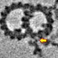 A photo taken through a cryo-electron microscope, showing the contrast and resolution described in the text