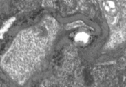 Short video of an optic nerve through an electron microscope