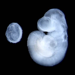 An image of a mouse fetus