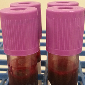 Plasma Aliquots and Storage Services