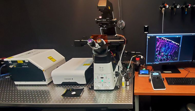 Nikon CSU-W1 SoRa spinning-disk confocal