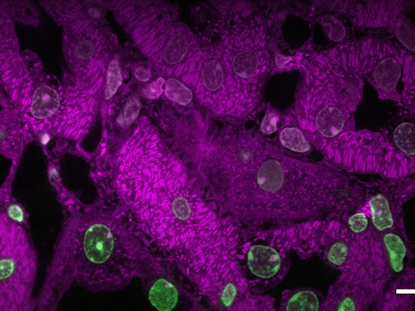 Expanded mouse liver image