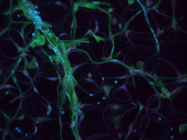 Expanded vascular flow image