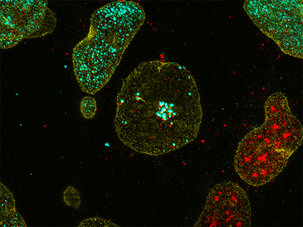 Expanded PCNA image