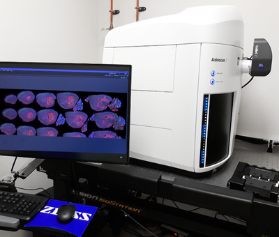 vernino research